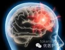 男子晨起洗澡致颅内动脉瘤破裂：健康管理与预防措施的行业洞察